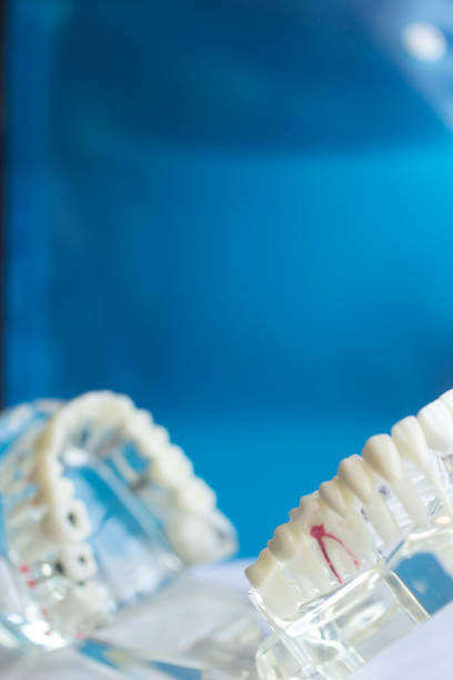 istock Dental teeth mouth dentists teaching model with teeth, gums, molars and wisdom tooth. 851107732