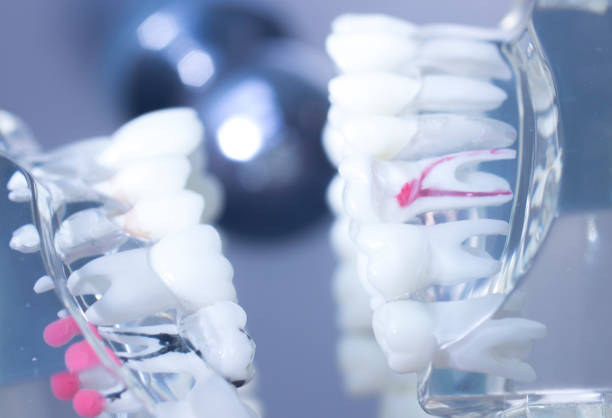 istock Dental teeth mouth dentists teaching model with teeth, gums, molars and wisdom tooth. 851110102
