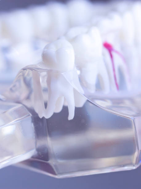 istock Dental teeth mouth dentists teaching model with teeth, gums, molars and wisdom tooth. 851110104