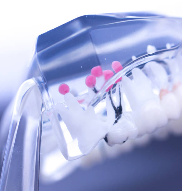 istock Dental teeth mouth dentists teaching model with teeth, gums, molars and wisdom tooth. 851110944