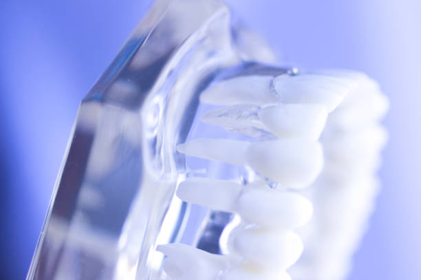 istock Dental teeth mouth dentists teaching model with teeth, gums, molars and wisdom tooth. 851111112