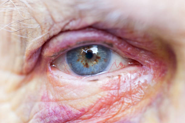 istock Injured elderly woman 852037296