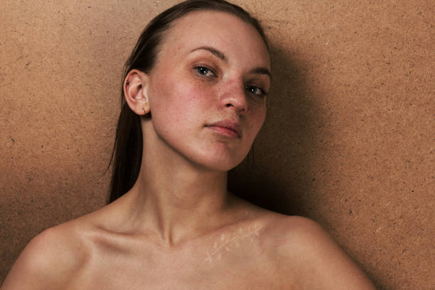 Closeup Mädchen Porträt mit einer Narbe auf ein Schlüsselbein – Foto