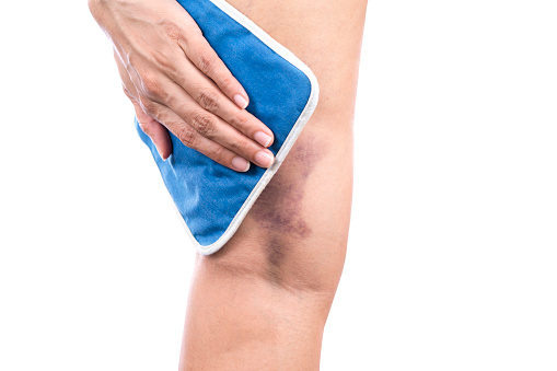 woman putting an ice pack on her leg pain isolated on white background