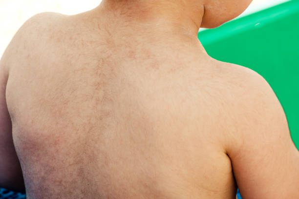 newborn hairy back - baby torso closeup child