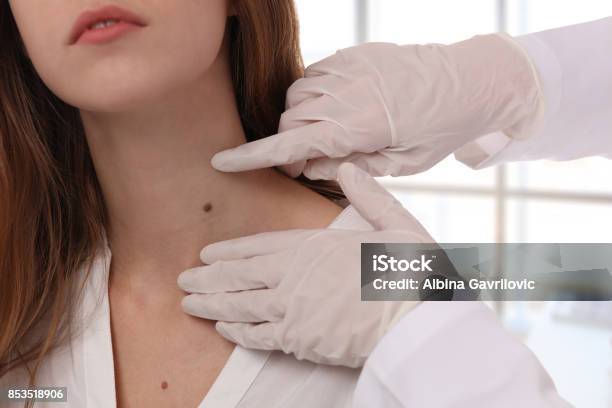 Doctor Dermatologist Examines Birthmark Of Patient Close Up Checking Benign Moles Laser Skin Tags Removal Stock Photo - Download Image Now
