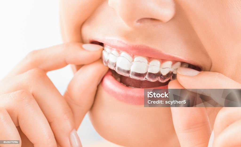 Schönes Lächeln und weiße Zähne einer jungen Frau. - Lizenzfrei Zahnschiene Stock-Foto