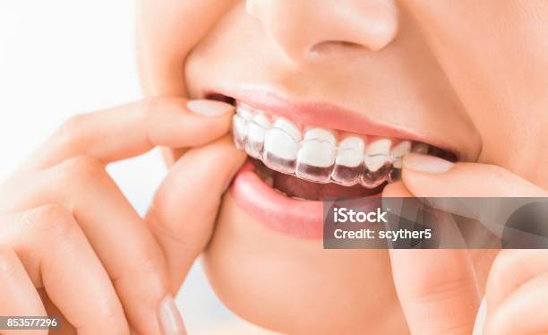 Schönes Lächeln Und Weiße Zähne Einer Jungen Frau Stockfoto und mehr Bilder von Zahnschiene - Zahnschiene, Zahnspange, Lächeln