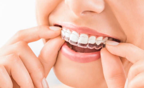 hermosa sonrisa y dientes blancos de una mujer joven. - blanqueamiento dental fotografías e imágenes de stock