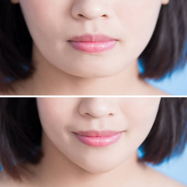 istock close up of surgery woman 853847152