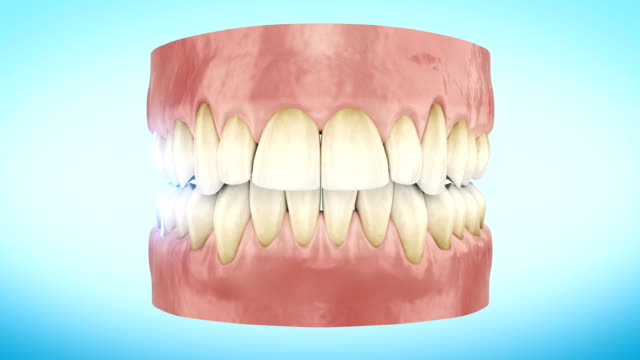 5,916 Teeth Whitening Stock Videos and Royalty-Free Footage - iStock | Teeth  whitening kit, Teeth whitening strips, Teeth whitening at home