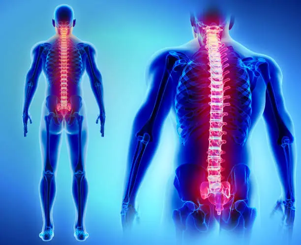 Photo of 3D illustration of Spine, medical concept.