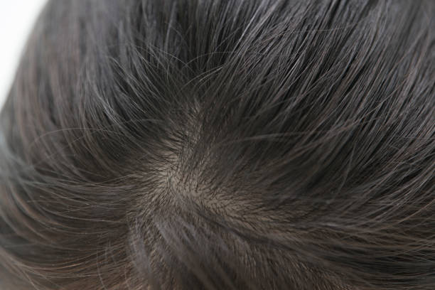 istock The appearance from the top of the head. 854885020