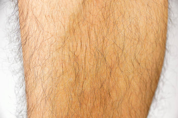 istock closeup of hairy leg 854972492