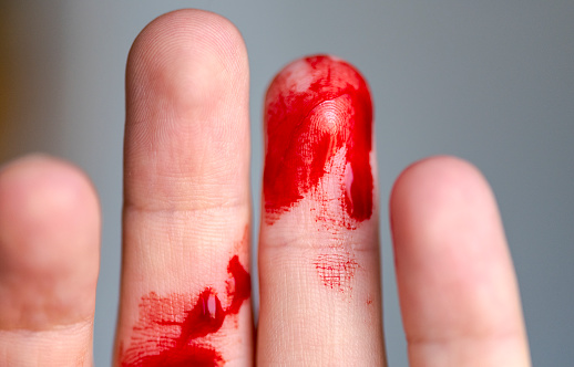 Wounded finger, arm with blood, bleeding