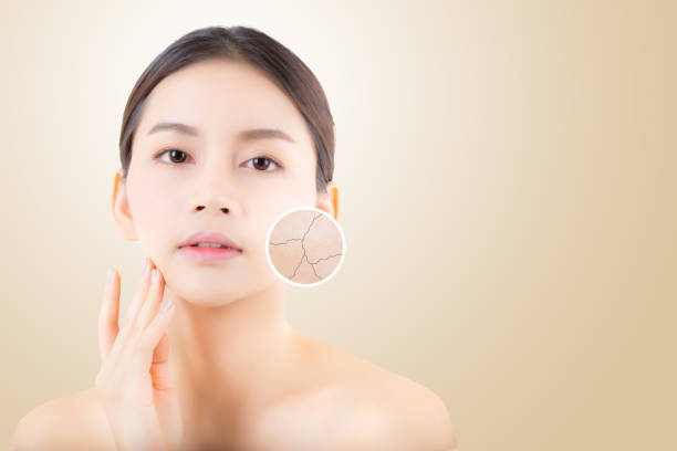 skincare and health and cosmetics concept - beautiful asian young woman face with wrinkles over circles for advertising. stock photo