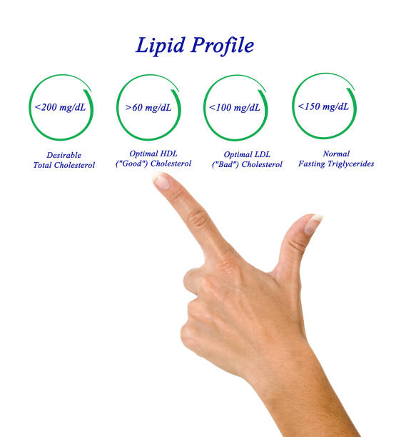 istock Diagram of Lipid profile 855524480