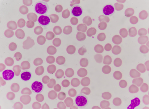 blood cells findingb with microscope.