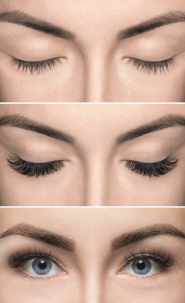 istock Eyelash removal procedure before and after close up. 855880330