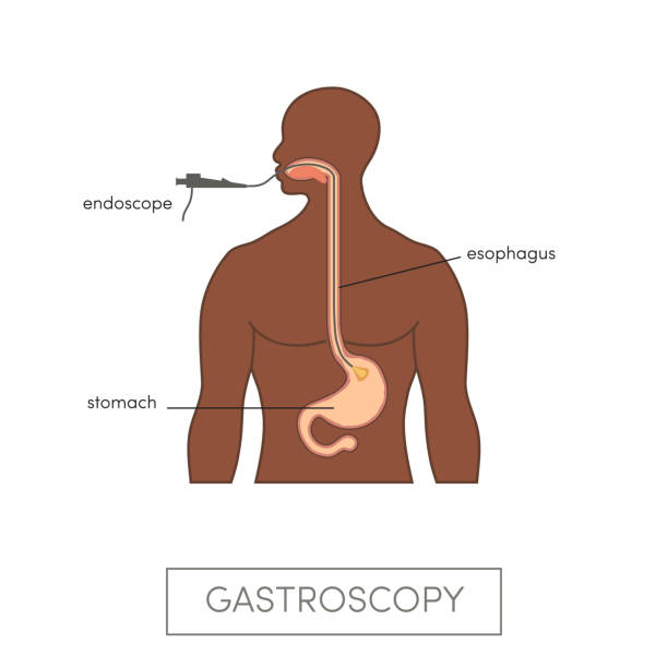 vektor-gastroskopie-konzept - endoskop stock-grafiken, -clipart, -cartoons und -symbole