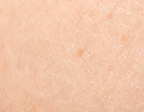 istock background of human skin 856125934