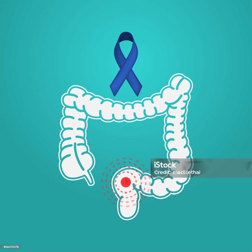 Colon Cancer vector symbol icon illustration Anatomy stock vector