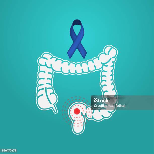 Colon Cancer Vector Symbol Icon Illustration Stock Illustration - Download Image Now - Anatomy, Care, Colon