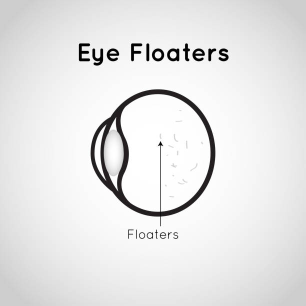 Eye Floaters symbol vector icon design illustration vector art illustration