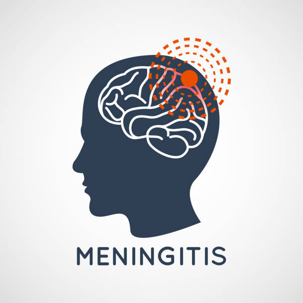 ilustrações, clipart, desenhos animados e ícones de meningite logo vector ícone design ilustração - meningite