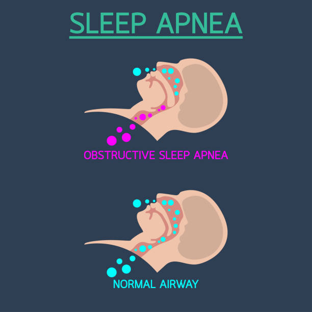 Sleep Apnea vector icon illustration vector art illustration