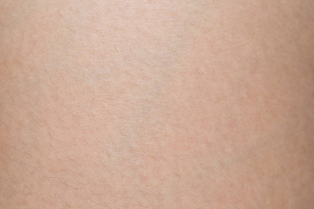 istock woman skin texture 856585220