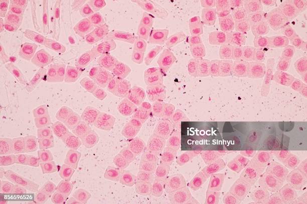 Root Tip Of Onion And Mitosis Cell In The Root Tip Of Onion Under A Microscope Stock Photo - Download Image Now
