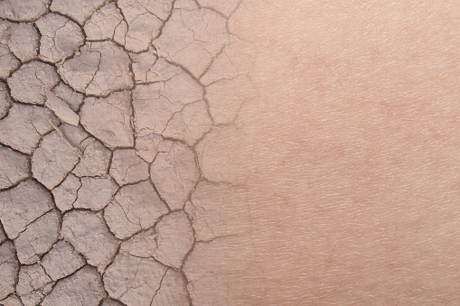 textura de la piel seca mujer con suelo seco photo