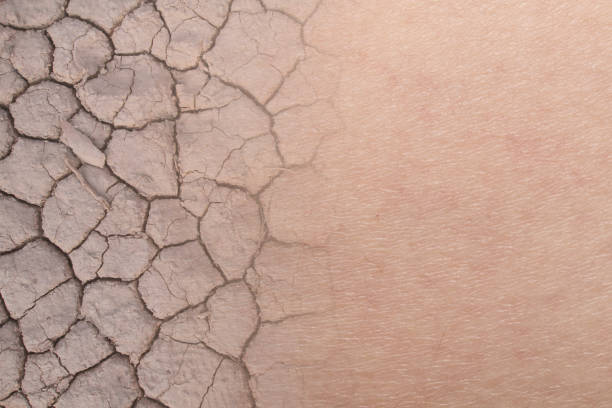 textura de la piel seca mujer con suelo seco - seco fotografías e imágenes de stock