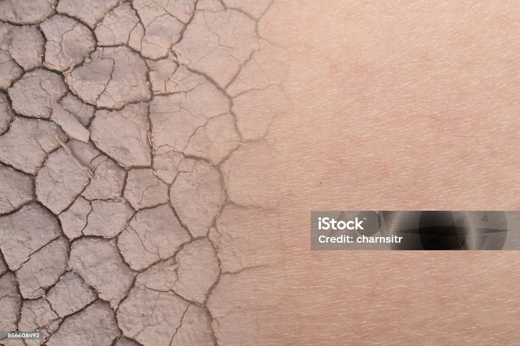dry woman skin texture with dry soil close-up on dry woman skin texture with dry soil Skin Stock Photo
