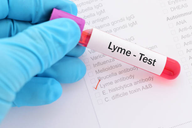 Lyme disease test stock photo