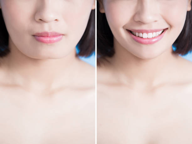 istock close up of surgery woman 856843094