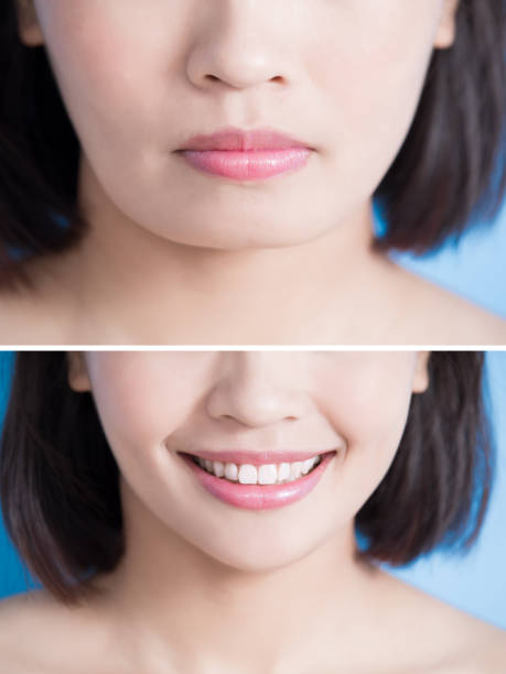istock close up of surgery woman 856845412