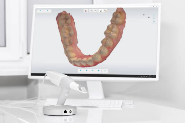 dental 3d scanner und monitor in der zahnarztpraxis - machine teeth fotos stock-fotos und bilder