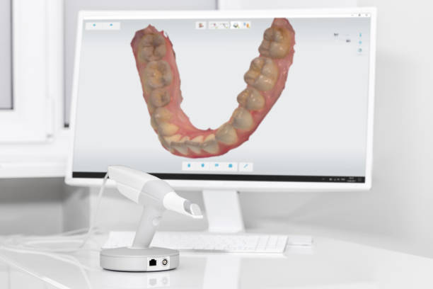 scanner e monitor dentali 3d nello studio del dentista - machine teeth immagine foto e immagini stock