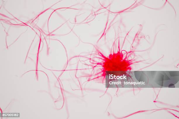 Cancer Cell In Human Under The Microscope View Stock Photo - Download Image Now - Biological Cell, Breast, Film and Television Screening