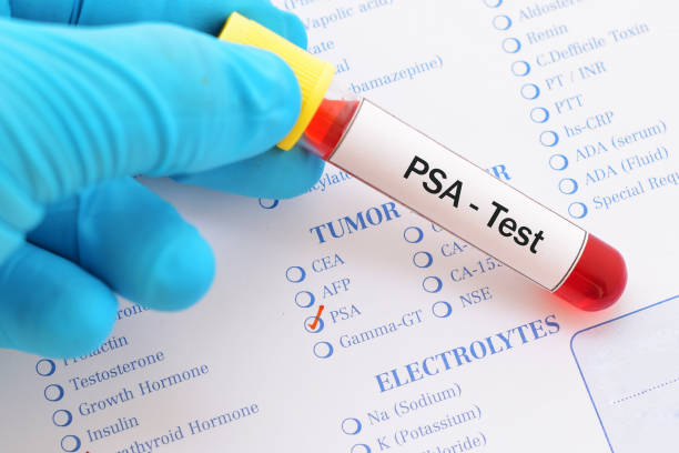 test psa - healthcare and medicine laboratory senior adult analyzing zdjęcia i obrazy z banku zdjęć