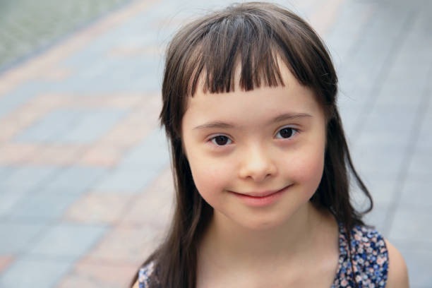 istock Cute smiling down syndrome girl 857318434