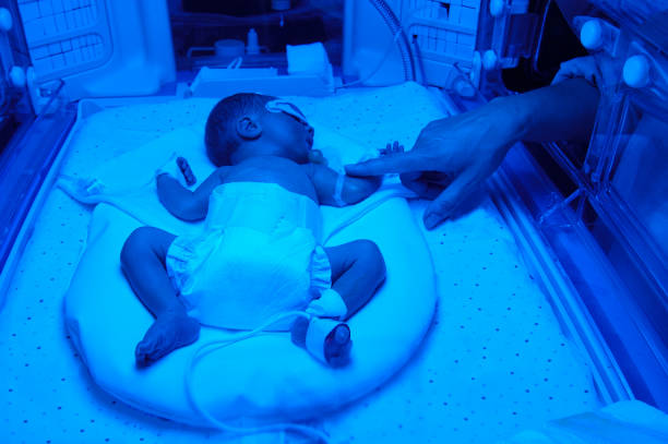 mère main toucher son nouveau-né en incubateur (unité néonatale de soins intensifs). bébé enfant ayant un traitement pour une jaunisse sous phototheraphy de lumière ultraviolette dans l’incubateur. avec émotion et avec émotion - yellowing photos et images de collection