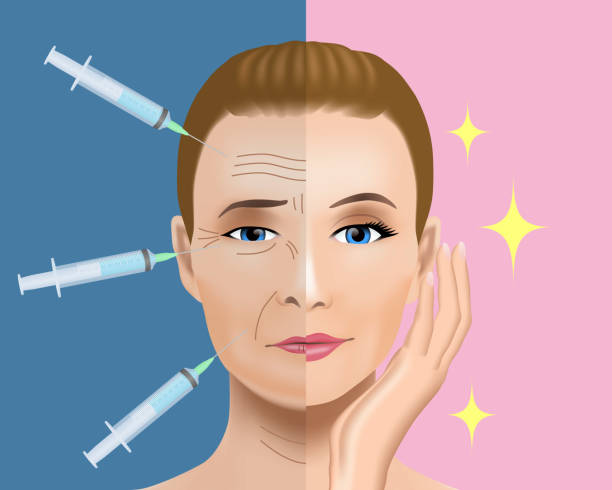 얼굴 주름 치료 후 전입니다. 성형 수술입니다. 여자 얼굴 치료 개념입니다. - plastic surgery botox injection face lift nose job stock illustrations