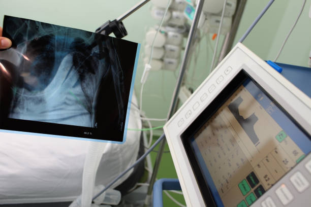 istock Examining x-ray in patient's room. 858504498
