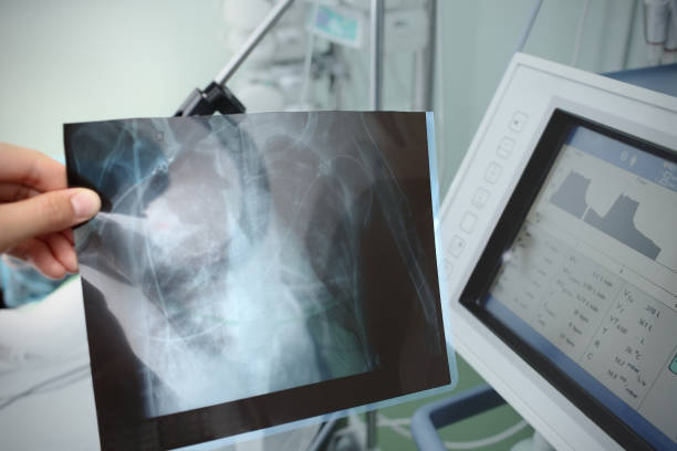 환자의 머리 맡에서 의사의 손에 x 선 - human lung audio 뉴스 사진 이미지