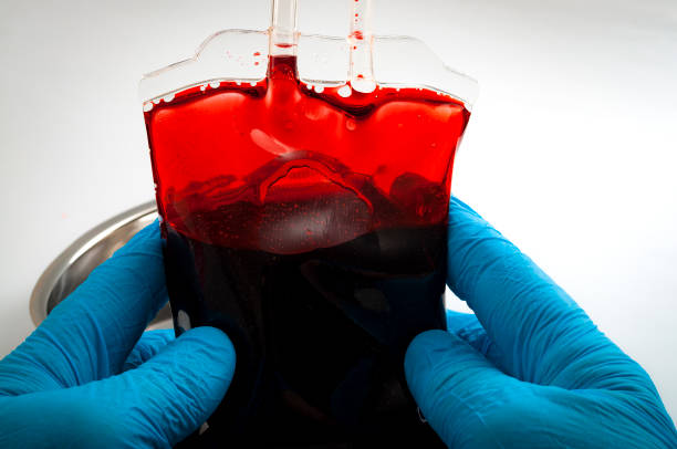 Medic examing a bloodbag Blood transfusion and donations to the blood bank concept with doctor or nurse wearing blue latex gloves and is holding a blood bag human blood stock pictures, royalty-free photos & images