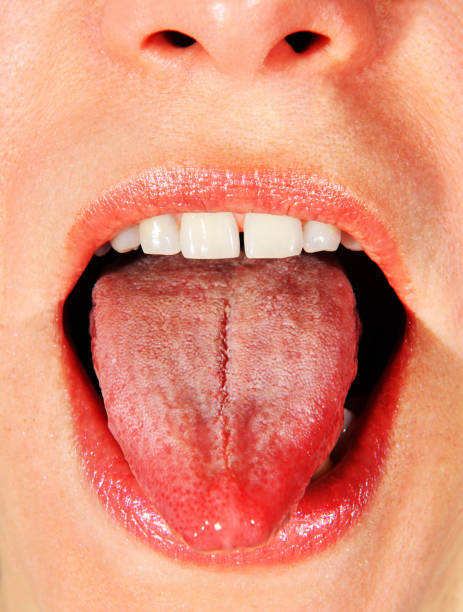 istock opened mouth of woman 859261984