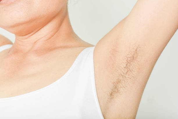 istock armpits and Hairy of women 859587680